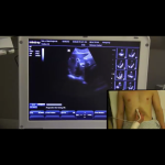 One Minute Ultrasound